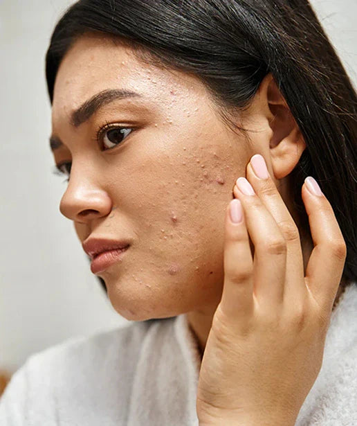 Skin Concerns