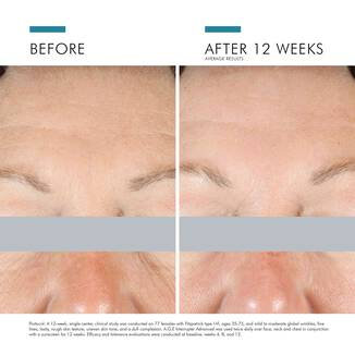 SkinCeuticals A.G.E. Advanced Eye