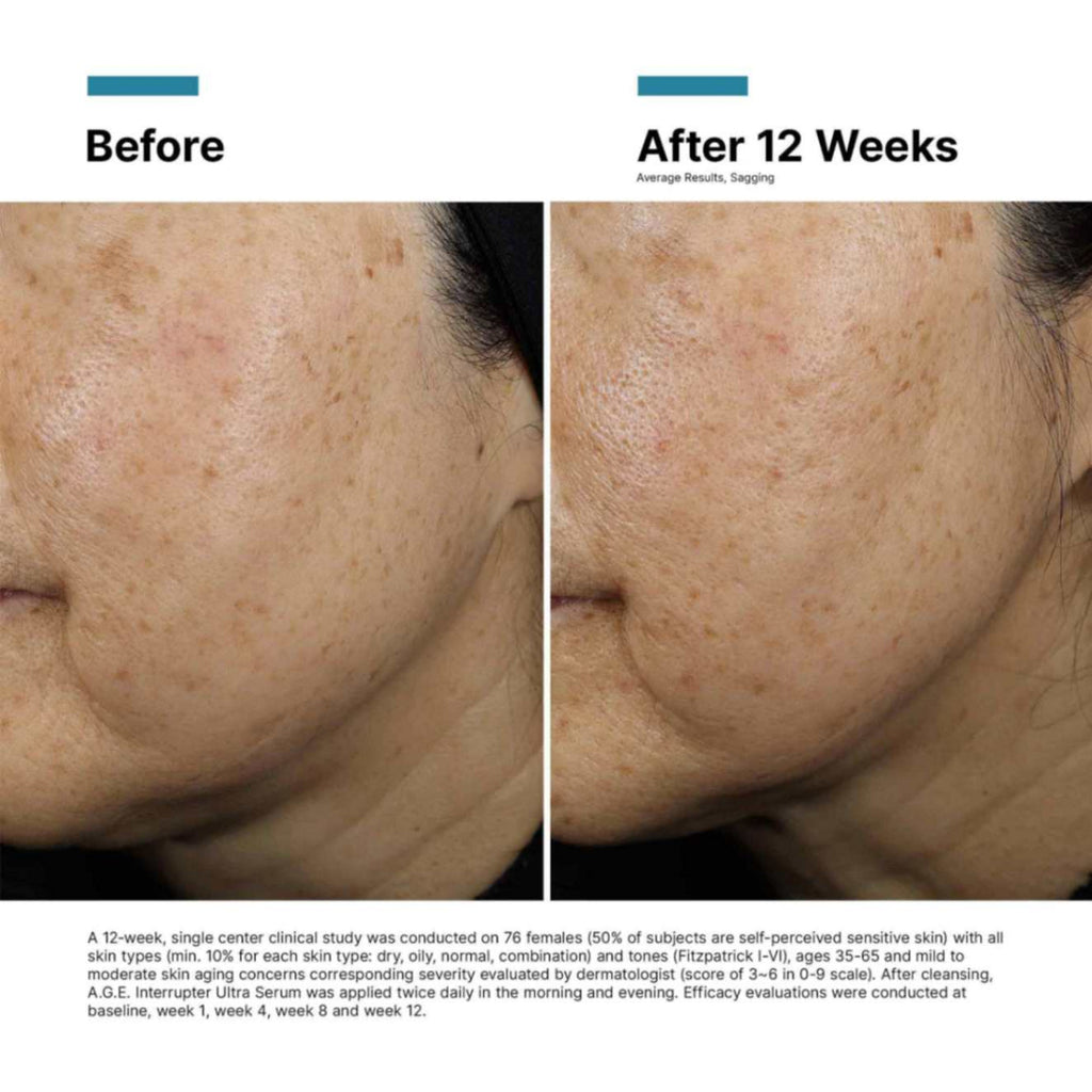 A.G.E. Interrupter Ultra Serum